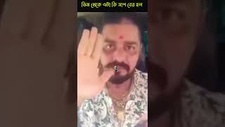 Moral Story Bangla | সাপের ডিম 🐍থেকে এটা কি বের হল 😲 #moralstory #respect #helpothers #shorts