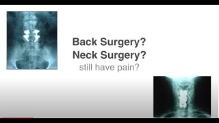 Post Back Surgery / Continued Pain Patients Hope with Chiropractic Cox Technic