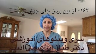 ۱۶۳- از بین بردن جای جوش