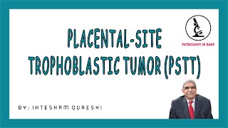 Placental Site Trophoblastic Tumor PSTT (Female Genital Tract)