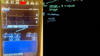 Principles of Mechanical Ventilation 7: Calculating I:E ratio in Volume Control