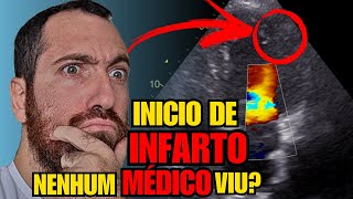 SINAIS DE INFARTO podem começar ANTES DOS SINTOMAS DE INFARTO! Veja um MIOCÁRCDIO no ECOCARDIOGRAMA