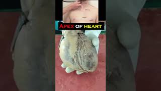 Apex of heart - location-Anatomy of heart full video in description #anatomy #heart #location #mbbs