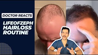 Doctor Reacts to LifeofZeph's Hairless Routine for Natural Hair Regrowth! 😳