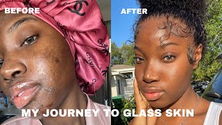 My First Chemical Peel Experience! | Getting Rid of Hyperpigmentation | Lou xoxo