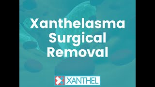 Xanthelasma Surgical Removal - Removing Xanthelasma with surgery ? - By XANTHEL ®