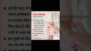 फंगल इन्फेक्शन।fungle infection के लिए आसान टिप्स।