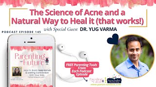 POF145: The Science of Acne and a Natural Way to Heal it (that works!)