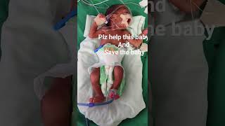 new born baby #1kg baby #plz help this baby to cure well #baby is serious condition #pray for baby#