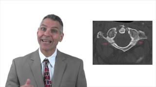 Burst Fracture After FL Accident | Leesburg Injury Lawyer