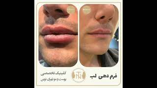 فیلم فرم دهی لب طبق سلیقه شما عزیزان