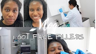 VLOG: I GOT UNDER EYE DERMAL FILLERS: @JaiTheRoyall X @DermaMedGrenada