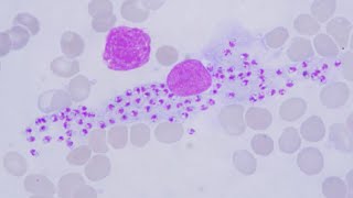 Leishmania, Chagas disease, and Talaromyces (Penicillium) marneffei