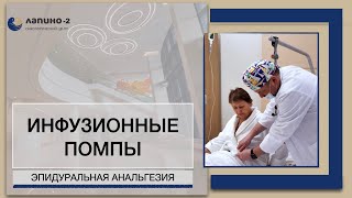 Инфузионные помпы. Эпидуральная анальгезия