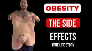 4 Shocking Side Effects of Losing Excess Weight You Need to Know