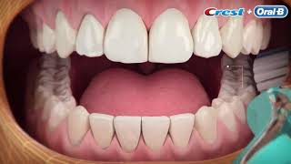 TÉCNICA DE CEPILLADO - ORAL B