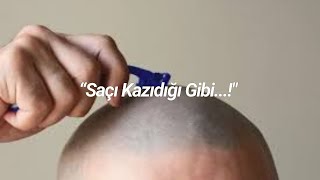 📌"Saçı Kazıdığı Gibi" (2dk 21sn)