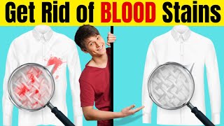 HOW to Get RID of BLOOD Stains From Cloths/Mattress FAST!