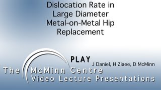 Dislocation Rate in Large Diameter Metal-on-Metal Hip Replacement - Hena Ziaee 2007