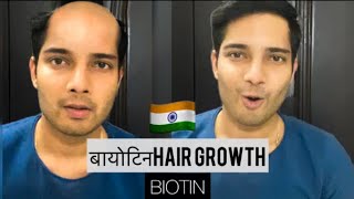 बायोटिन| BIOTIN hair growth results before and after| Hair growth| HAIRFALL REMEDY| hairloss| Hindi