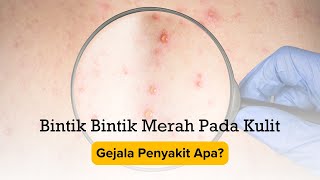 Bintik - Bintik Merah Pada Kulit Gejala Penyakit Apa?