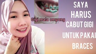 CABUT GIGI BONENG UNTUK PAKAI BRACES/BEHEL.