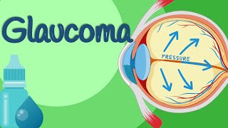 Glaucoma: Why It Happens, Symptoms, Risk Factors & Treatment | Open Angle vs Angle Closure Glaucoma