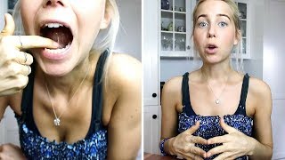 My Tongue Tie Surgery Experience