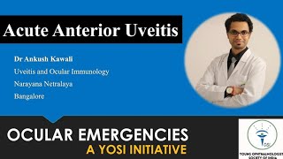 Acute Anterior Uveitis | Dr Ankush Kawali | YOSI Ocular Emergency | Episode 14