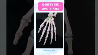 identify the marked bone #neet #pg #preparation