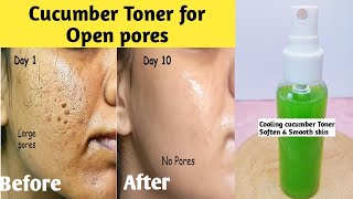 Cucumber Toner for Open Pores/How to make toner/Diy cucumber toner at home/Homemade toner