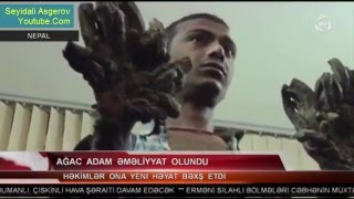 Agac adam/Ağac adam