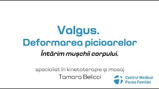 Valgus. Deformarea picioarelor. Intervenție și tratament.