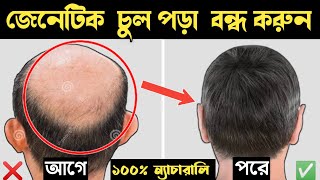 জেনেটিক চুল পড়া বন্ধ করে নতুন চুল গজানোর উপায় 🔥 Genetic Hair Loss Solution | টাক মাথায় চুল গজান