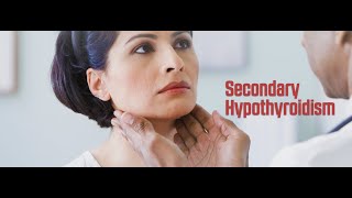 Secondary Hypothyroidism