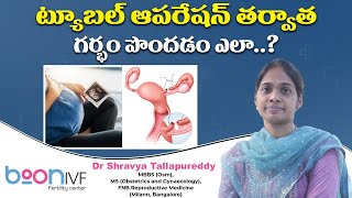 ట్యూబల్ ఆపరేషన్ తర్వాత గర్భం పొందడం ఎలా..? || How to Get Pregnant After Tubectomy || Boon Fertility