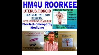 Remove Uterine Fibroids  Without Surgergy By Electro Homeopathic & HomeopathicMedicine//By:Y.K Gupta