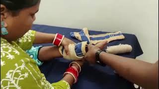 #Bow Legs Deformity in Children (Genu Valgus/Valgum deformity).