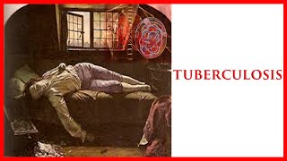 ✅ La mas antigua de las PANDEMIAS  |😷😷 La TUBERCULOSIS  a través de la HISTORIA | 2021