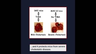 Using tetrahydroxylated bile acids for therapy of liver diseases?