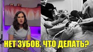 Что делать, когда совсем не осталось зубов? Протезирование по протоколам Все-на-4 и Все-на-6