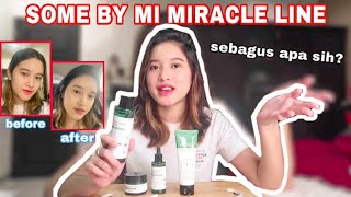 REVIEW SOME BY MI AHA BHA PHA 30 DAYS MIRACLE LINE, SKINCARE KOREA YANG VIRAL! | Aurelliaurel