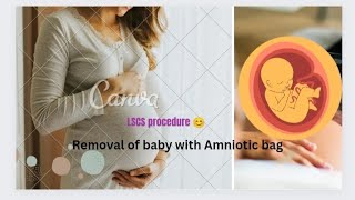 Baby with Amniotic bag 💰