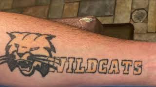 Laser tattoo removal Wild Cats forearm tattoo