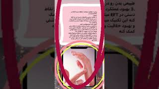 برخی از خواص استفاده از نقطه دست کاراته در EFT