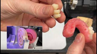 Milled AllonX with Teeth and Base Separated - Complicated Case!!